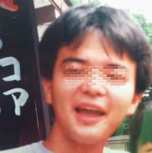 私のハゲ戦記